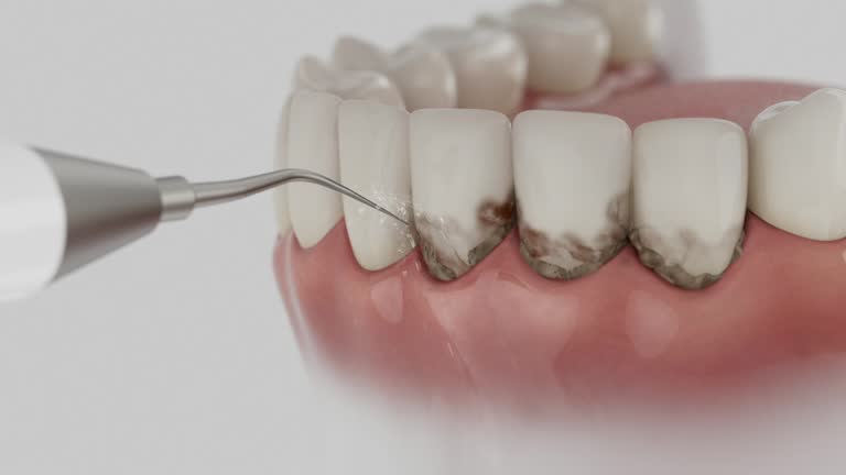 Reliable Emergency Dentist contractor in Gantt, SC by Smile Center Dentistry